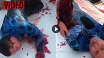 لحظه دلهره آور نجات غواص زخمی پس از حمله مرگبار کوسه