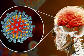 سکته مغزی ۲۵ بیمار مبتلا به ویروس کرونا در بیمارستان شهدای تجریش + فیلم