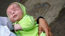 تولد نوزاد بدون چشم در روسیه!