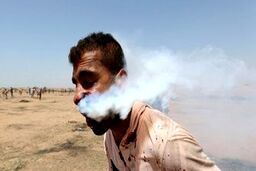 شلیک مستقیم گلوله گاز اشک آور به صورت جوان فلسطینی
