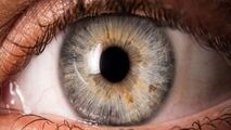 لکه‌های روی عنبیه چشم ، چه چیزی درمورد سلامتتان می گوید؟