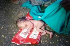 مورچه ها نوزاد دختر را زنده زنده خوردند!  (18+) + تصاویر