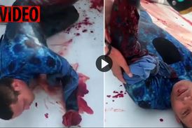 لحظه دلهره آور نجات غواص زخمی پس از حمله مرگبار کوسه