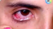 اشک‌های بلورینی که از چشمان دختر ۲۲ ساله سرازیر می‌شود