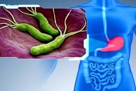 
میکروب هلیکوباکتر چگونه وارد بدن می‌شود؟