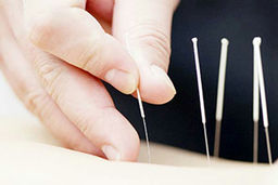 تلاش چین برای صدور طب سنتی خود!