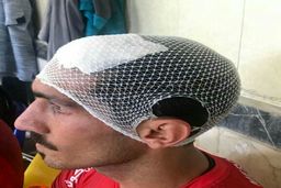 پرتاب سنگ و توقف بازی سپیدرود و ملوان انزلی/ فیلم 